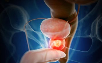 Cáncer de próstata: Cómo la tecnología médica puede ayudar a salvar vidas