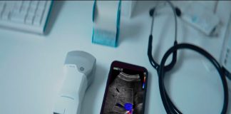 GE Healthcare revoluciona la atención de la salud con nuevo ultrasonido portátil de bolsillo