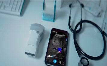 GE Healthcare revoluciona la atención de la salud con nuevo ultrasonido portátil de bolsillo