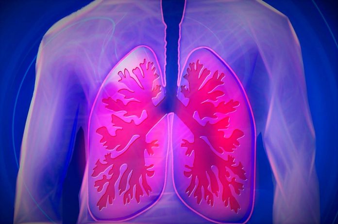 Neumonía causada por Covid-19 puede dejar importantes secuelas respiratorias | Portal Red Salud