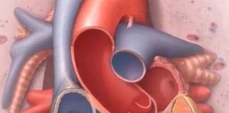 Mayo Clinic es la primera en usar imágenes de ecocardiograma intracardíaco cuadridimensional para ayudar a pacientes con enfermedades anatómicas del corazón