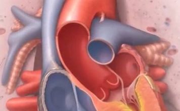 Mayo Clinic es la primera en usar imágenes de ecocardiograma intracardíaco cuadridimensional para ayudar a pacientes con enfermedades anatómicas del corazón