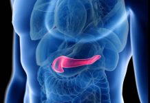 El trasplante de páncreas cura la diabetes explicación de un experto de Mayo Clinic