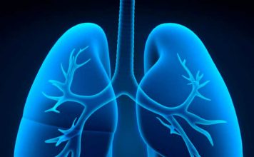 Experto de Mayo Clinic Healthcare ofrece sugerencias para respirar mejor pese a la enfermedad pulmonar obstructiva crónica