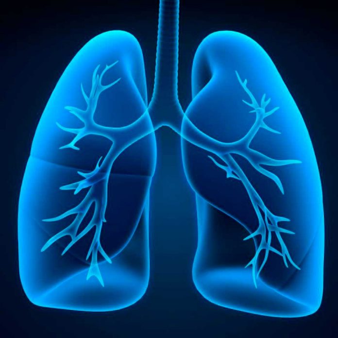 Experto de Mayo Clinic Healthcare habla sobre la enfermedad pulmonar obstructiva crónica provocada por el humo