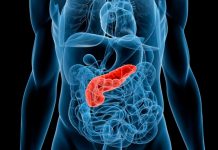 Importante incremento en el cáncer de páncreas en los próximos años: ¿existe posibilidad de revertir esta situación?