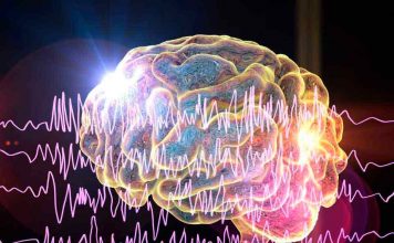 Estudio muestra factibilidad de predecir convulsiones con dispositivos de pulsera en personas que sufren de epilepsia