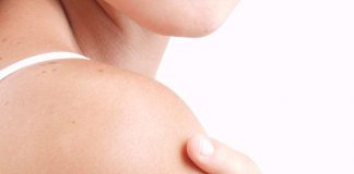 Conozca los oficios con mayor riesgo de contraer cáncer de piel
