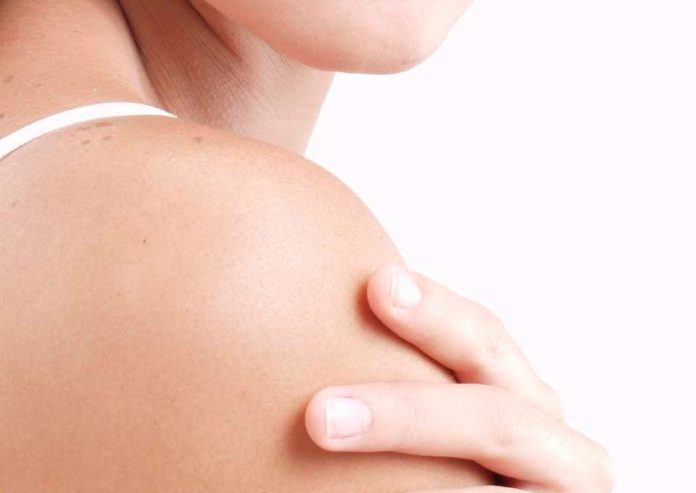 Conozca los oficios con mayor riesgo de contraer cáncer de piel