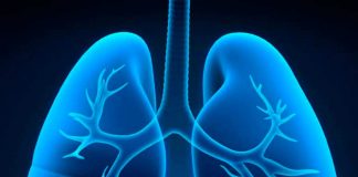 Estudio mundial descubrió que síndrome metabólico aumentó riesgo de síndrome de dificultad respiratoria aguda y muerte en pacientes hospitalizados por COVID-19