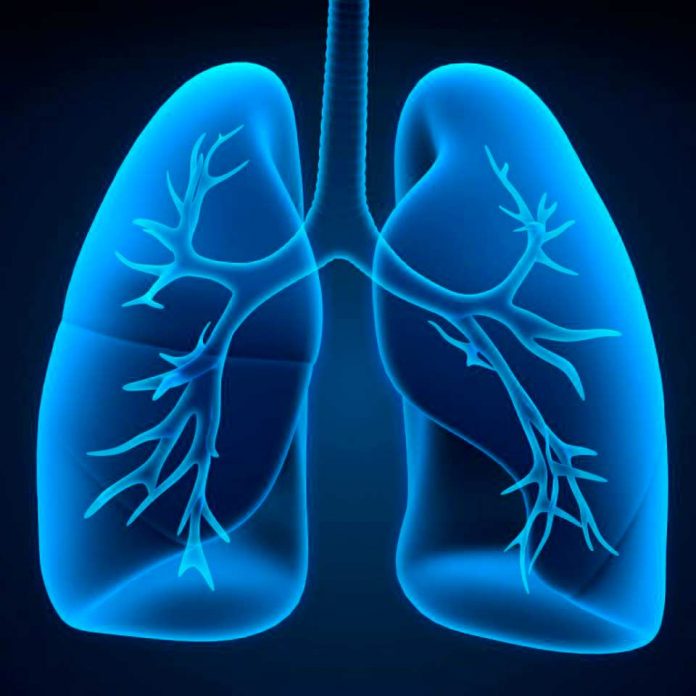 Estudio mundial descubrió que síndrome metabólico aumentó riesgo de síndrome de dificultad respiratoria aguda y muerte en pacientes hospitalizados por COVID-19