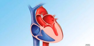 Mayo Clinic Healthcare añade exámenes y tratamiento para personas con afecciones cardíacas hereditarias