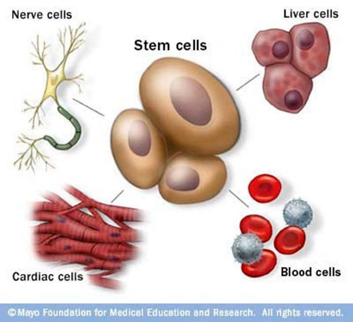 Encuesta de Mayo Clinic analiza por qué los pacientes solicitan tratamientos con células madre