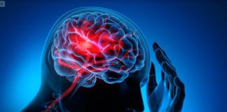 Uno de cuatro personas en Chile sufrirá un Ataque Cerebro Vascular a lo largo de su vida