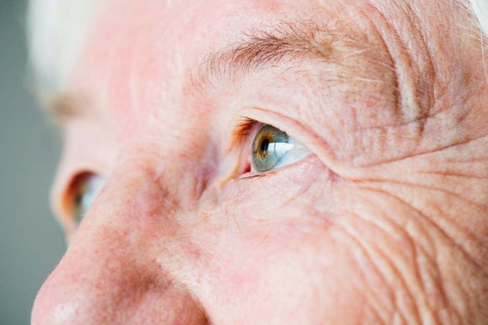 Glaucoma la primera causa de ceguera irreversible a nivel mundial