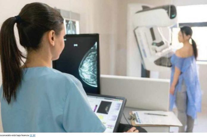 Se publicó en el Diario Oficial la Ley 21.551 Expertos valoran eliminación de orden médica para la mamografía