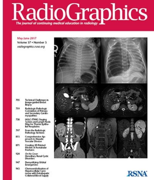 Revista internacional líder en radiología publica artículos de especialista de Atrys Chile