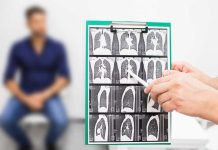 Detección precoz de la fibrosis pulmonar: la clave para que tus pulmones no sigan cicatrizándose