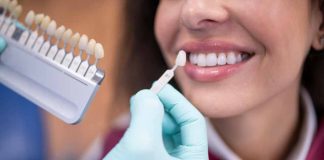 Blanqueamiento dental: expertos advierten riesgos de hacerlo sin indicación médica